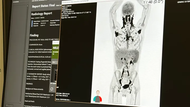 Cam Niles PET scan